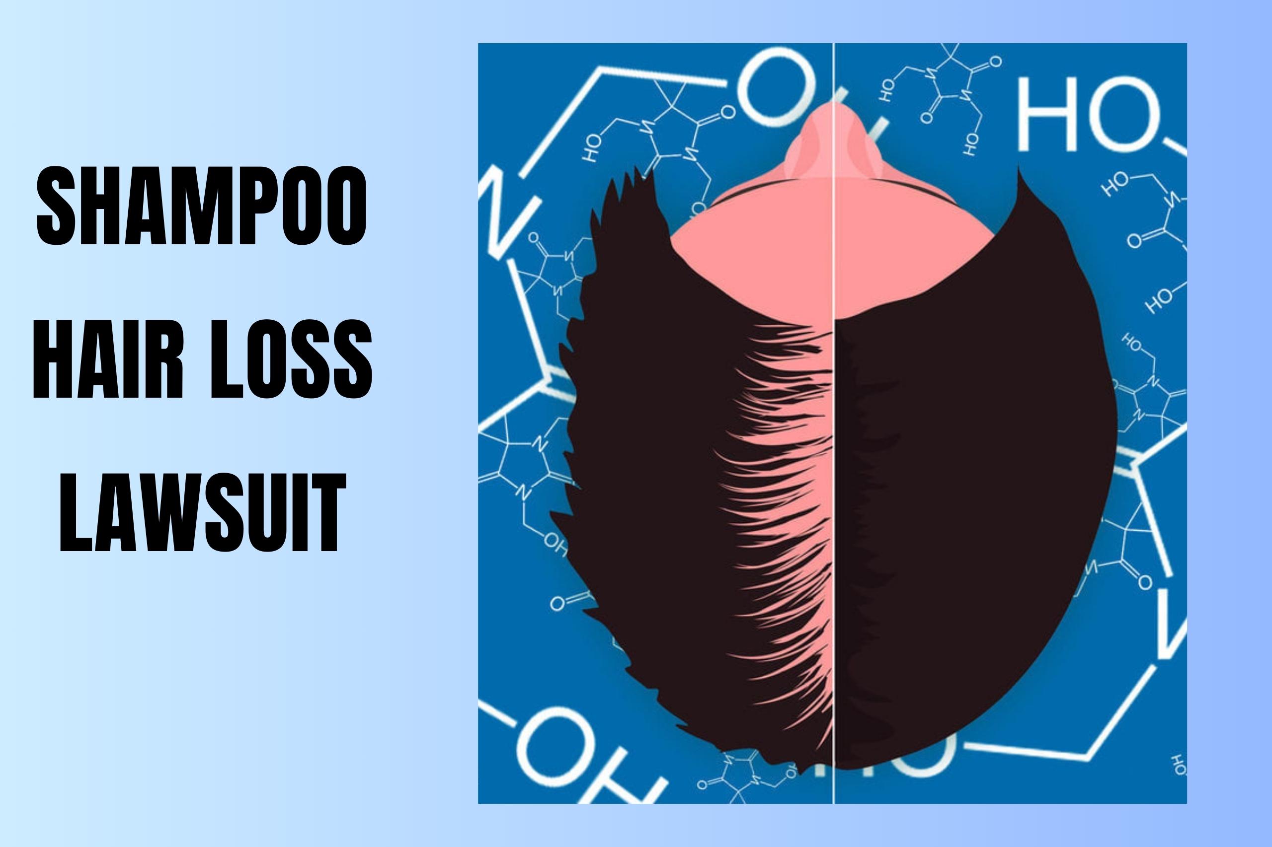 Understanding The Function Of Beauty Hair Loss Lawsuit: A Detailed Overview