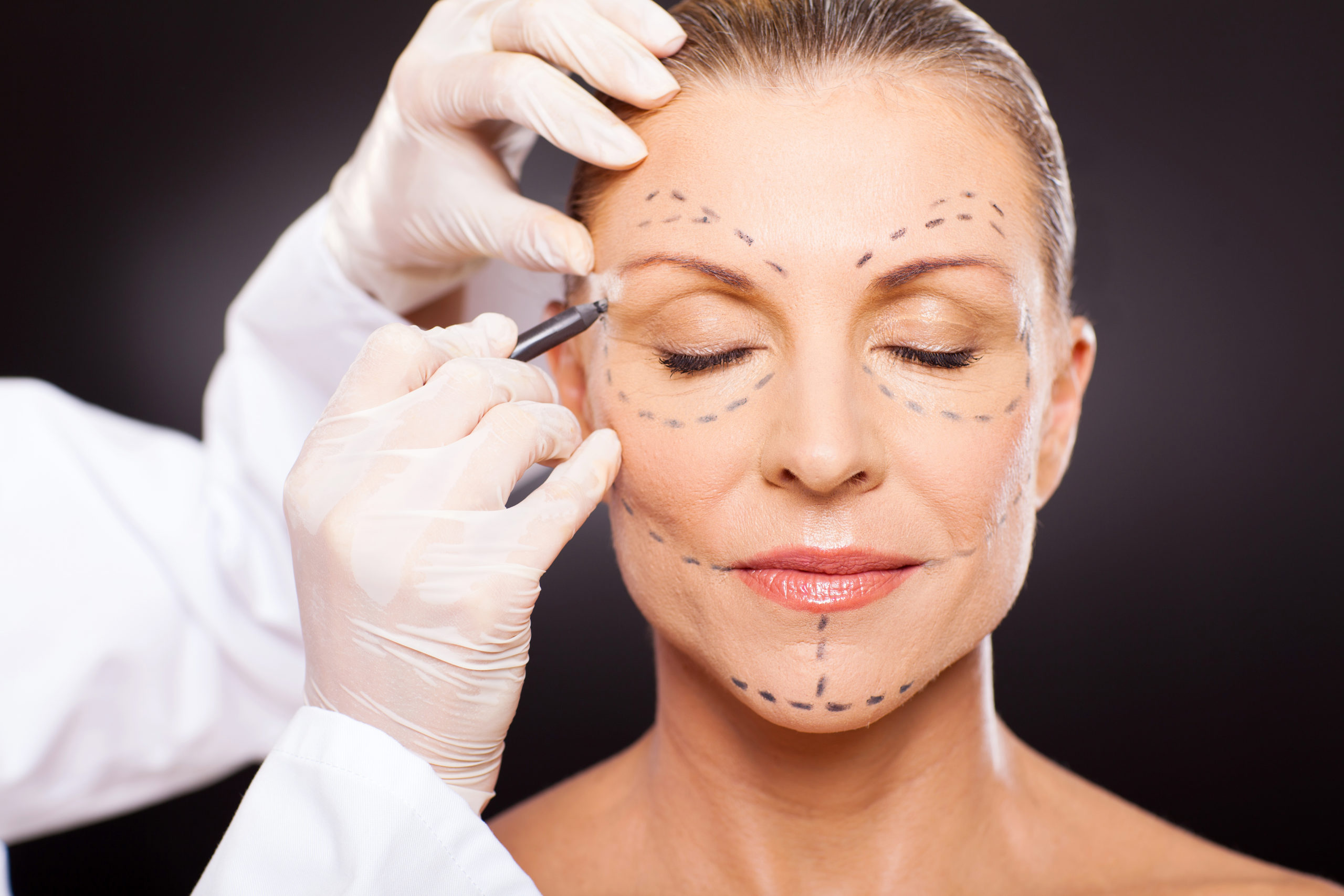 Understanding The Average Cost Of A Facelift: A Financial Guide